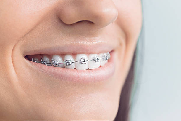 Best Traditional Braces  in Mila Doce, TX